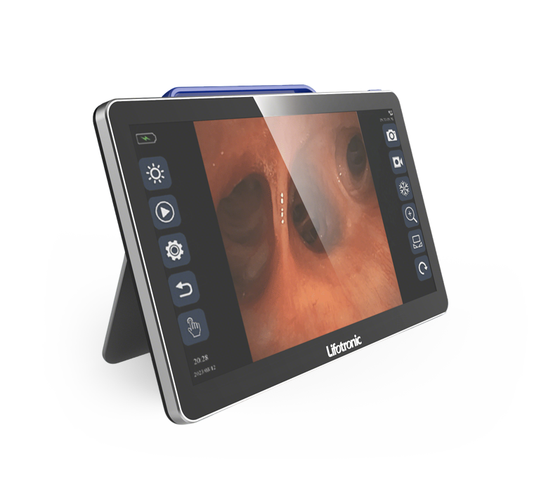 电子内窥镜图像处理器